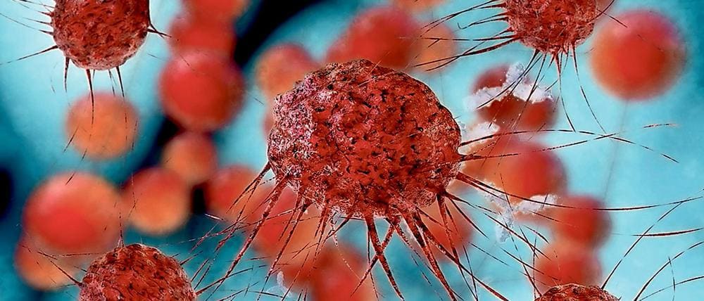 Breast Cancer Cells
